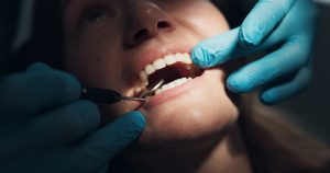 rehabilitación oral en Valencia