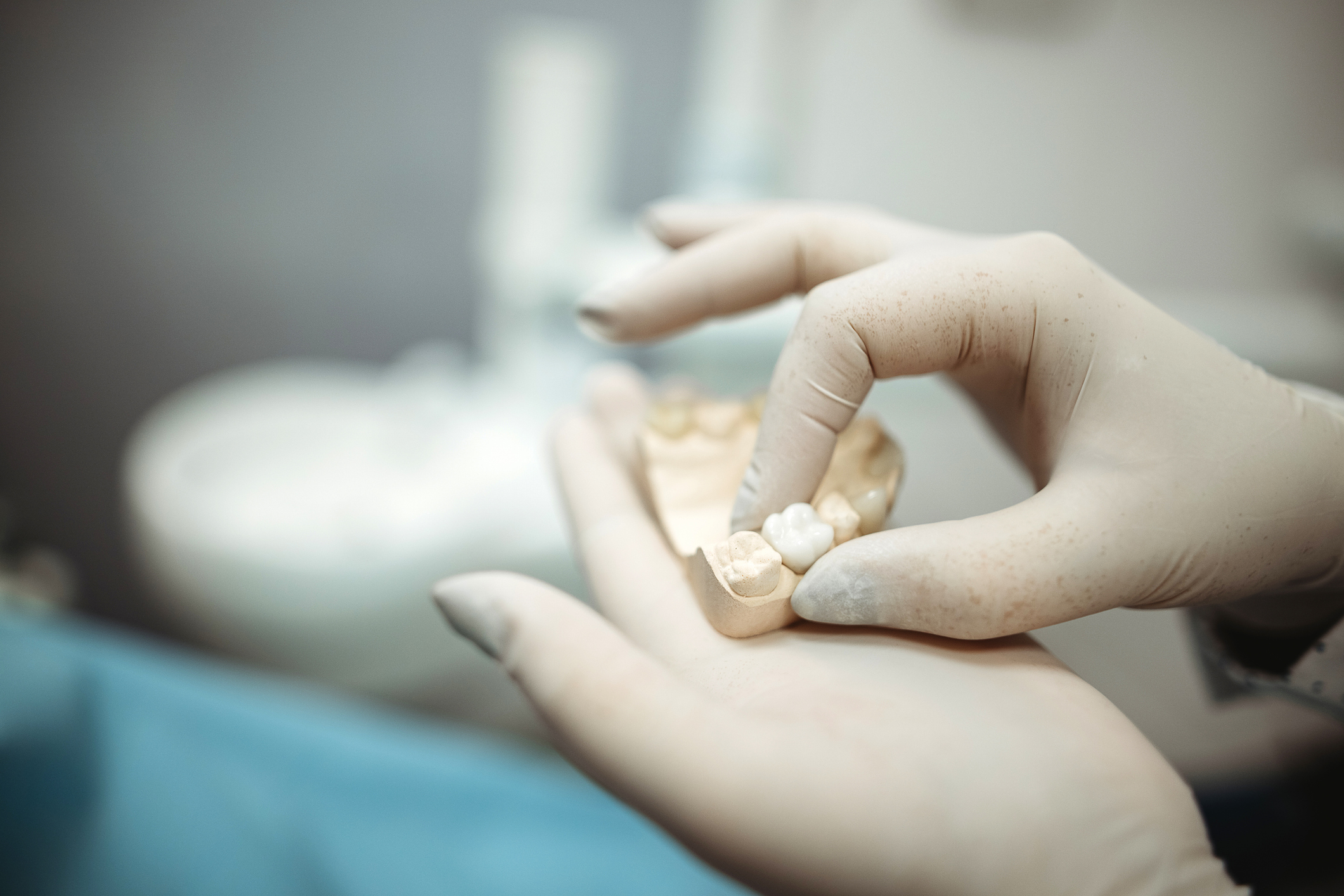 prótesis o implantes dentales