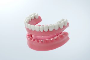 rehabilitación oral