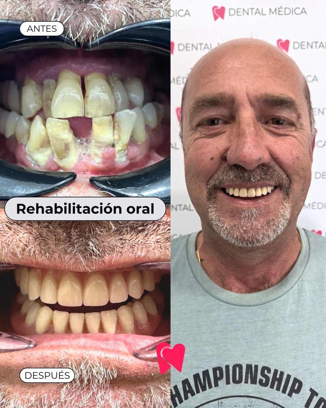 reelsvideo.io_1782202095626