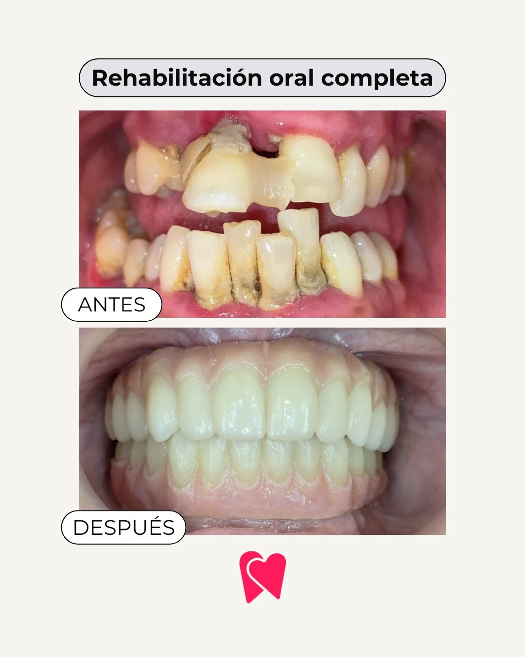 reelsvideo.io_1782202158779